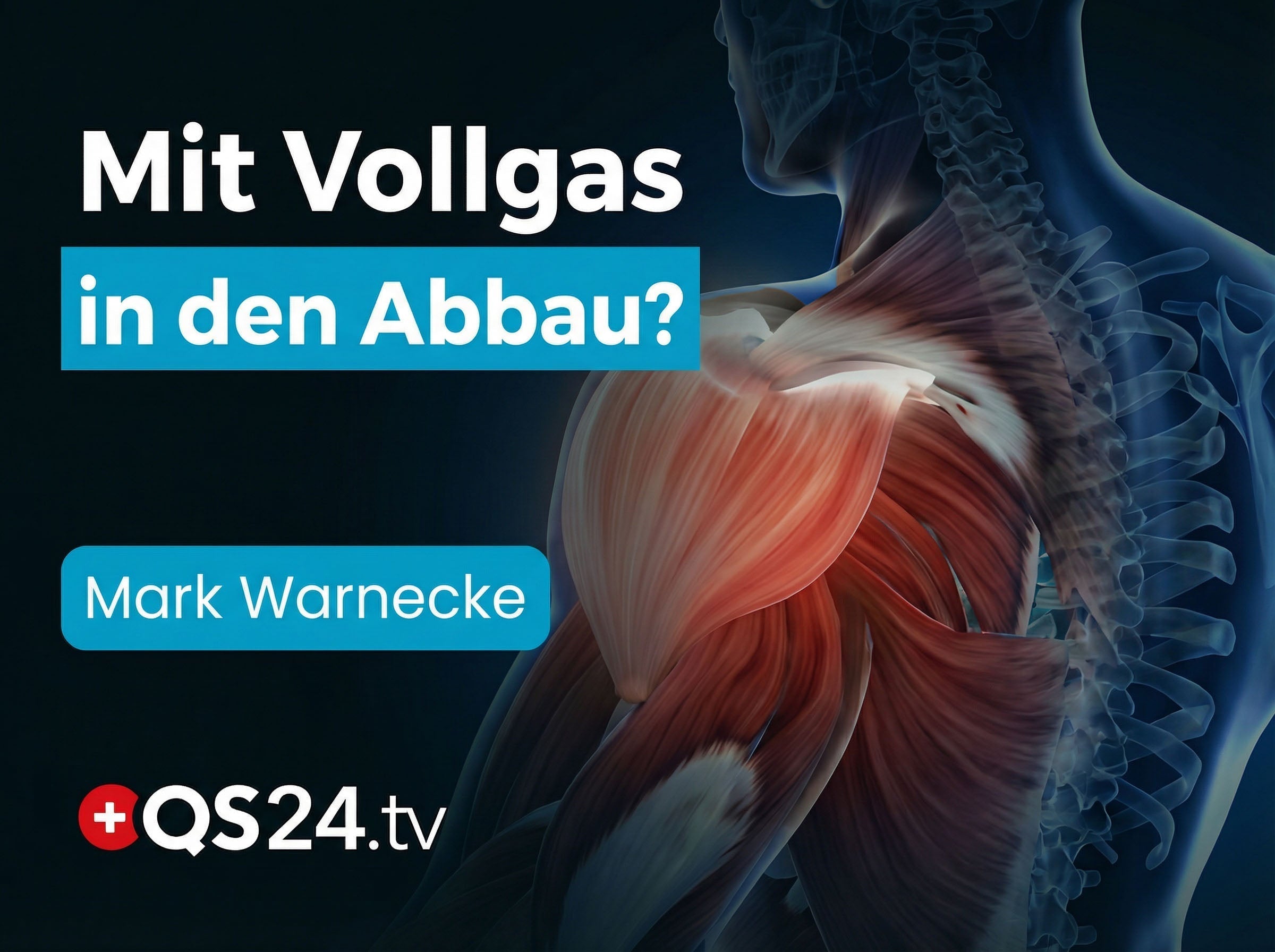 Ohne diese Basis verlieren Sie den Kampf gegen den Abbau!